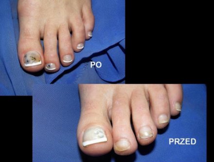 paznokcie.jpeg